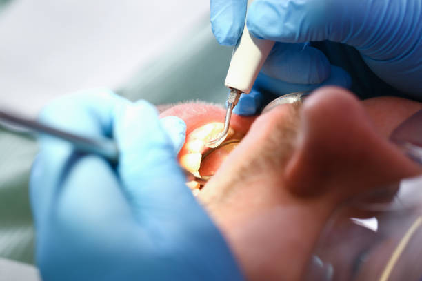 Best Emergency Dental Extractions in Elkton, VA